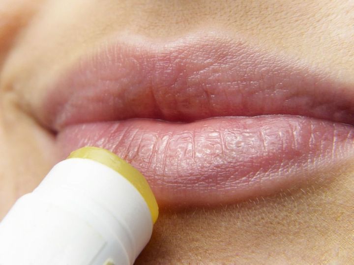 Как себе помочь, если вылезла простуда на губах: 10 копеечных, но эффективных средств