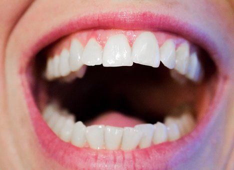 На наличие каких 6 болезней могут указывать наши зубы